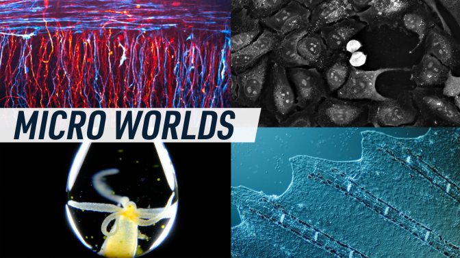 A collage shows different cells and organisms under a microscope. Caption reads "Micro worlds'